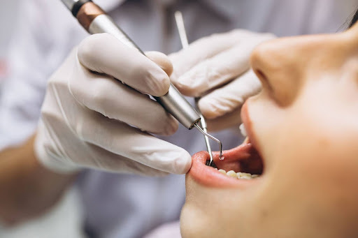 Cosmetic Dental Treatments In Texas
