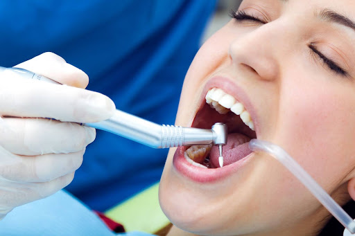 Dental Polishing for Oral Health