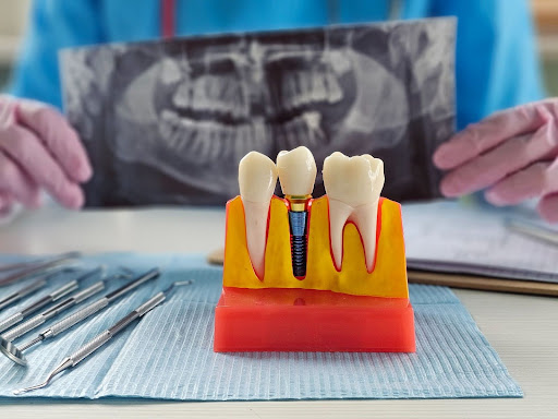 Smoking Increases the Risks Associated