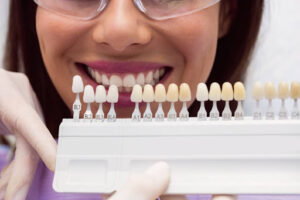 Composite Bonding Teeth