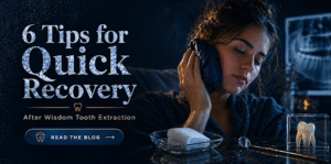 6 Tips for Quick Recovery