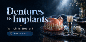 Dentures vs Implants