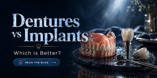 Dentures vs Implants