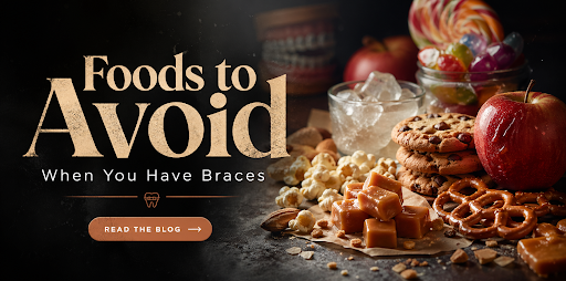 Foods to Avoid When You Have Braces