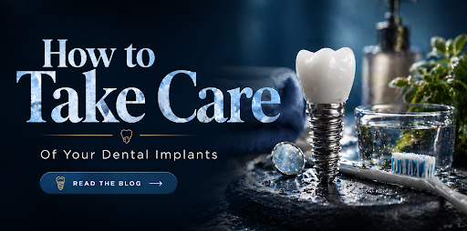Take Care of Your Dental Implants