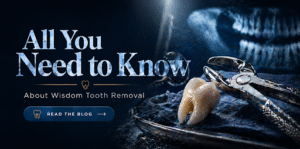 Wisdom Tooth Removal