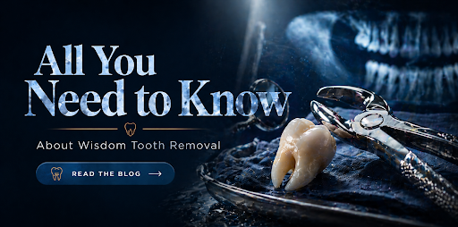 Wisdom Tooth Removal