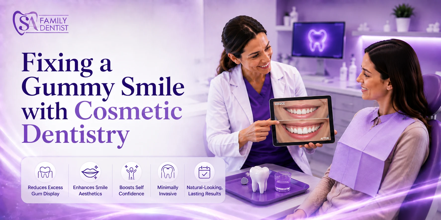 Gummy Smile What Causes It and the Cosmetic Dentistry