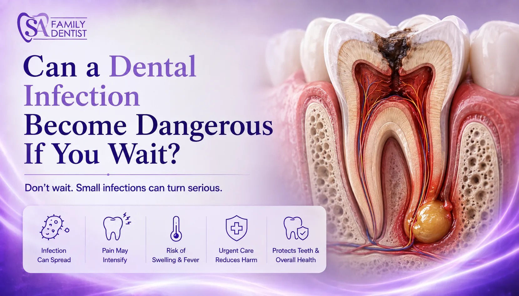Can a Dental Infection Become Dangerous