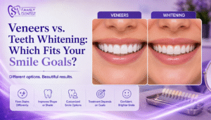 Veneers vs. Teeth Whitening